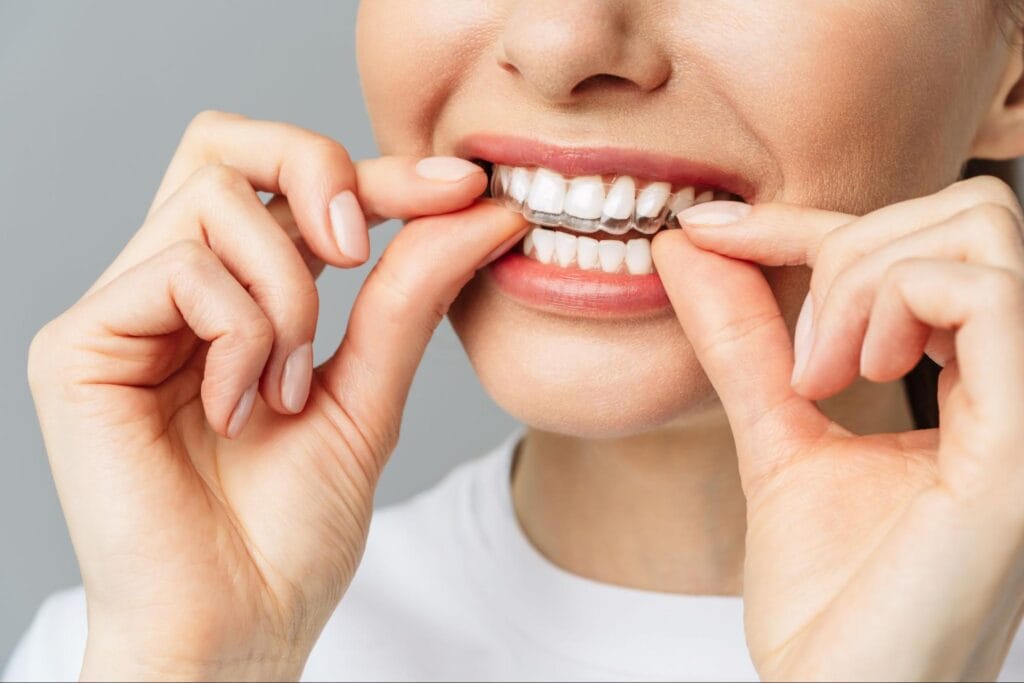 Invisalign Leicester