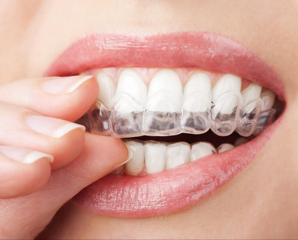 dentist Leicester