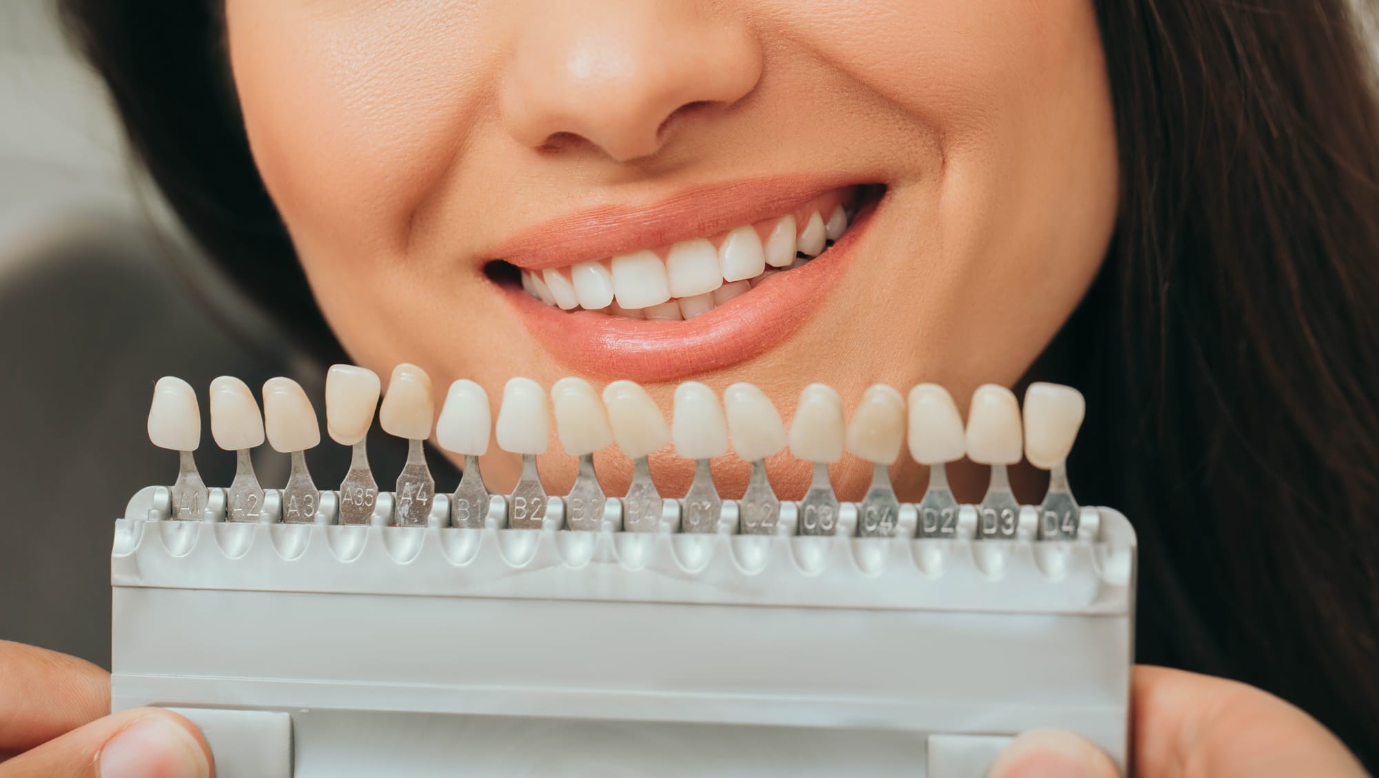 teeth palette with different shades of teeth near female smiling. Stomatology, whitening teeth,