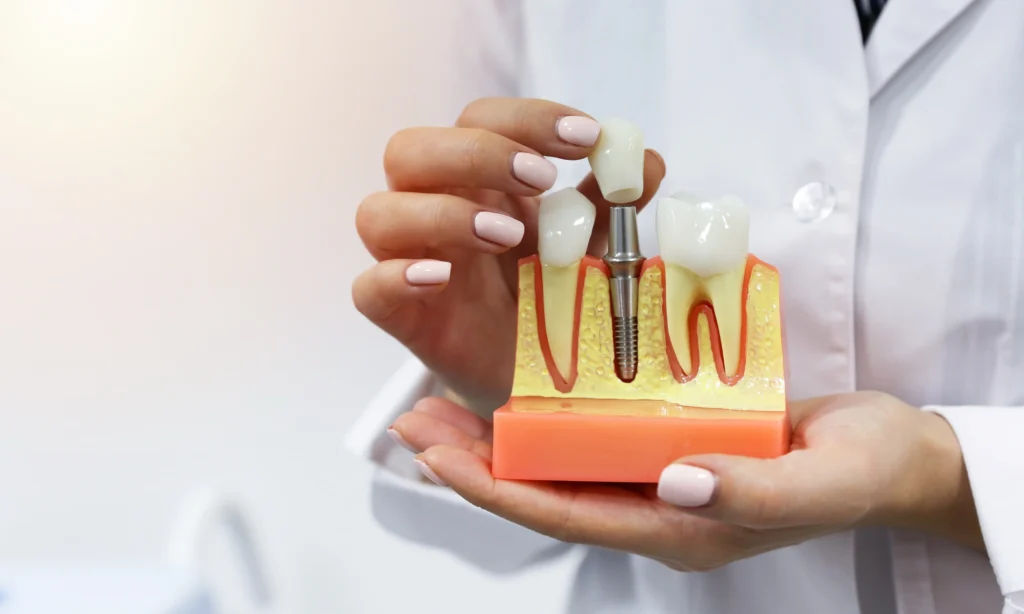 How Much Do Dental Implants Cost in Leicester? An Honest Price Breakdown